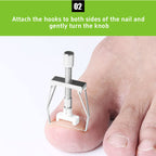 8-piece set Foot groove inflammation corrector