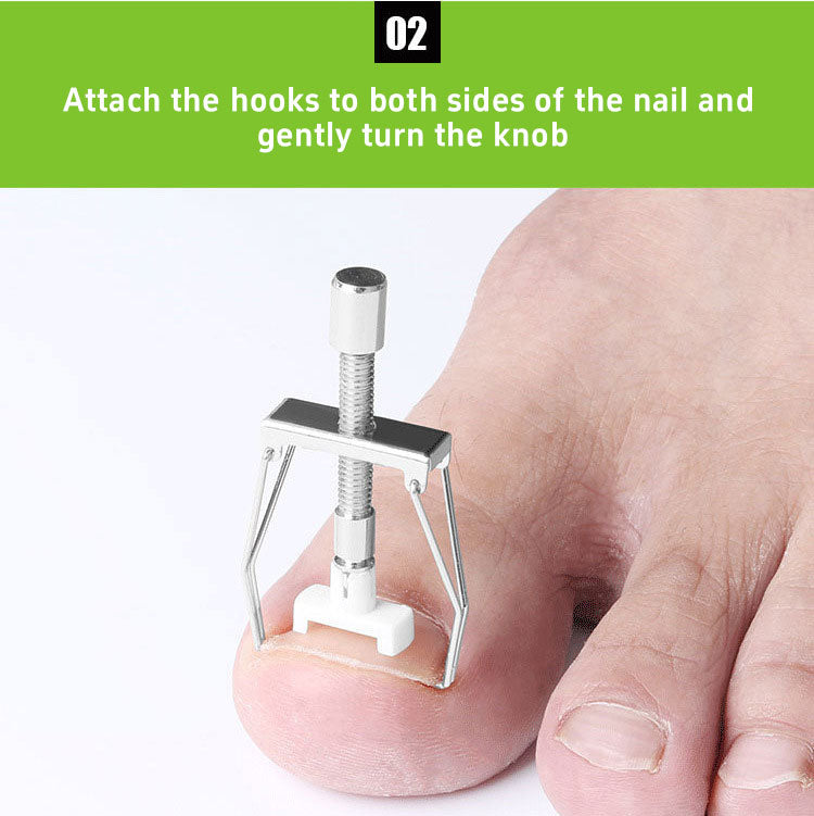 8-piece set Foot groove inflammation corrector